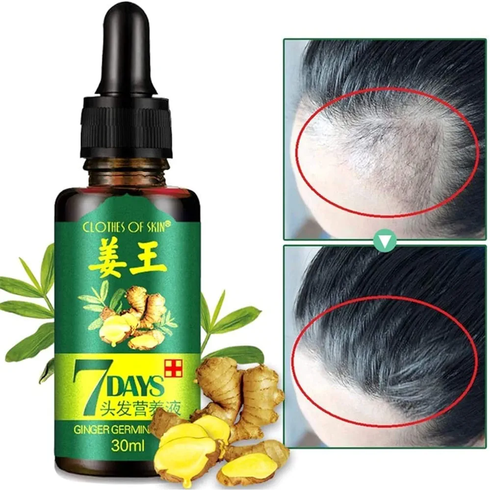 7 jours huile germinale de gingembre poussé cheveux
